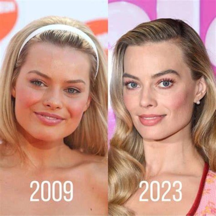 Margot Robbie Plastic Surgery Before and After