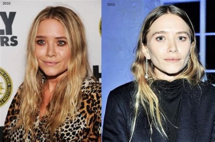 Mary-Kate Olsen Plastic Surgery Before and After