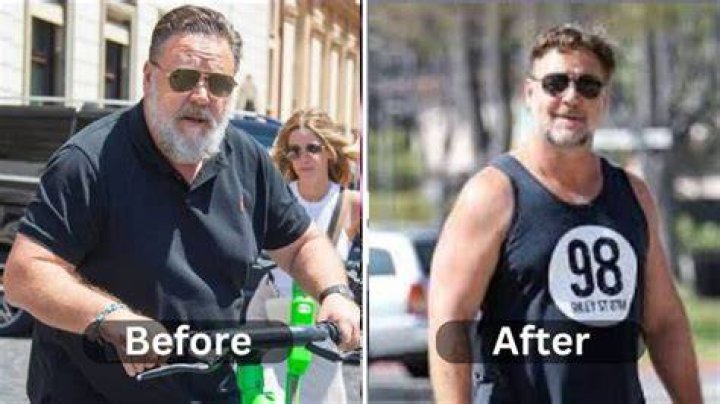 Russell Crowe Plastic Surgery Before and After