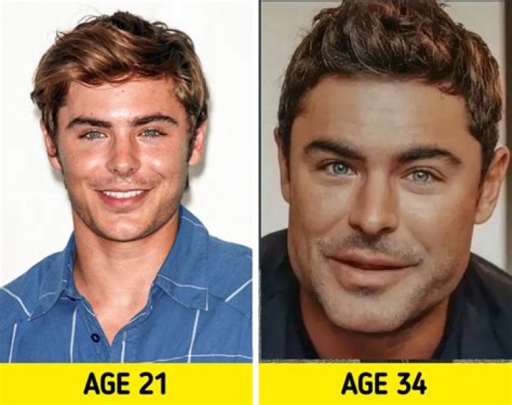 Zac Efron Plastic Surgery Before and After